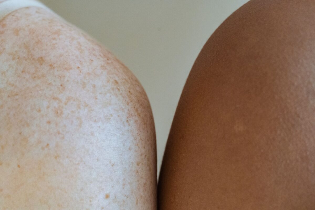 gommage avant après cas usage profil